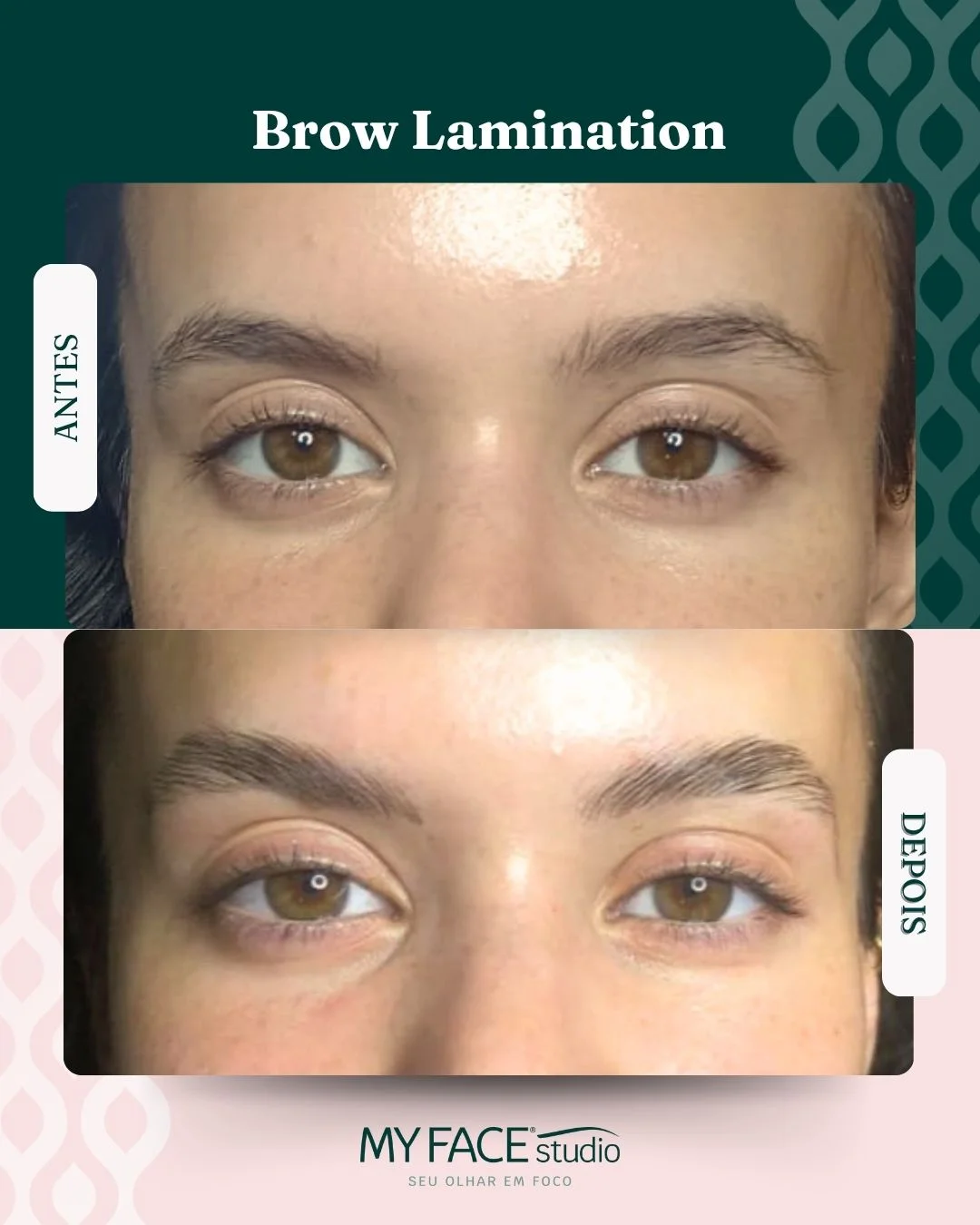 Brow Lamination: antes e depois identificados no post original MyFace