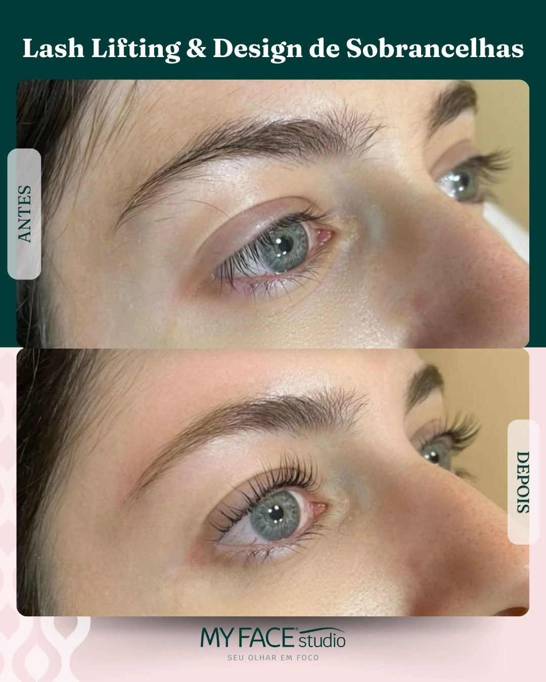 Lash Lifting & Design de Sobrancelhas: antes e depois identificados no post original MyFace