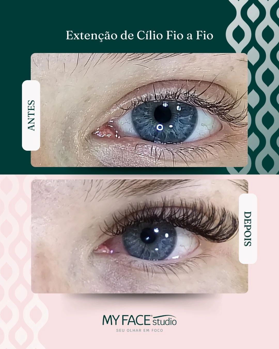 Extensão de Cílios — Fio a Fio: antes e depois identificados no post original MyFace
