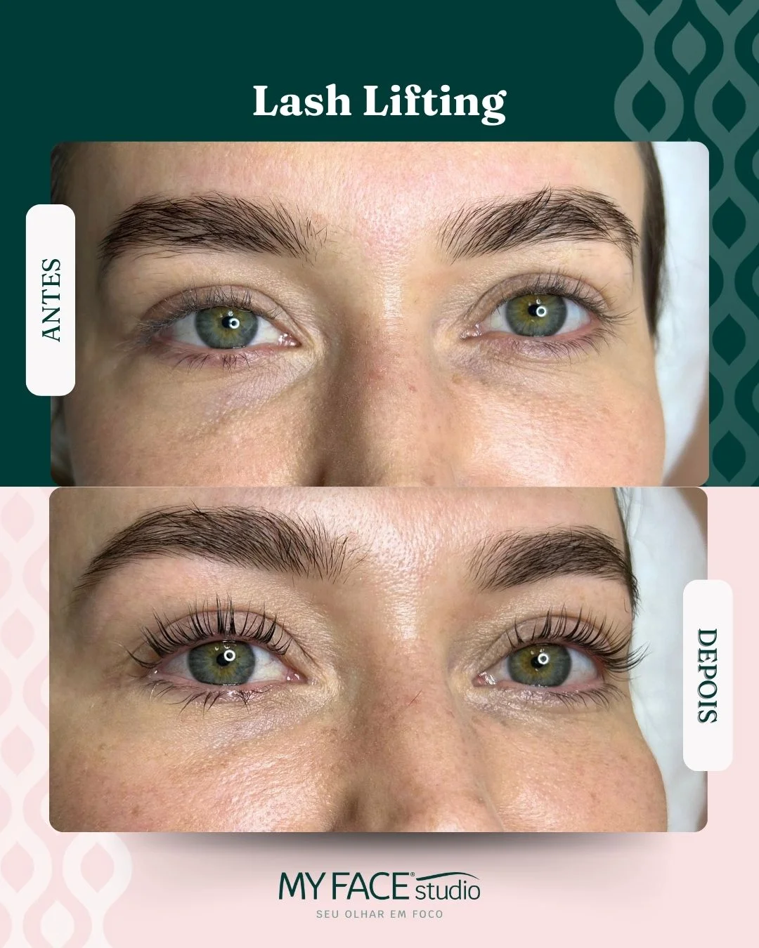 Lash Lifting: antes e depois identificados no post original MyFace