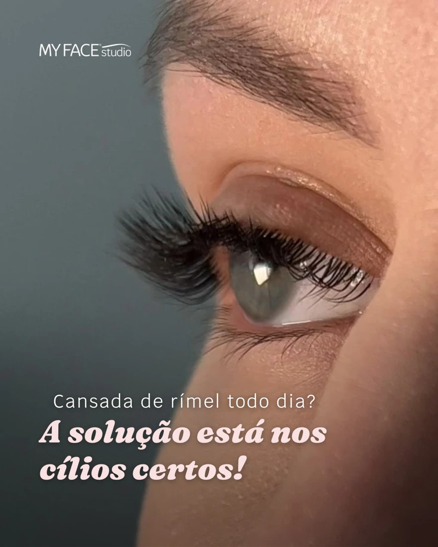 Um olhar do seu jeito. Post original do Instagram MyFace